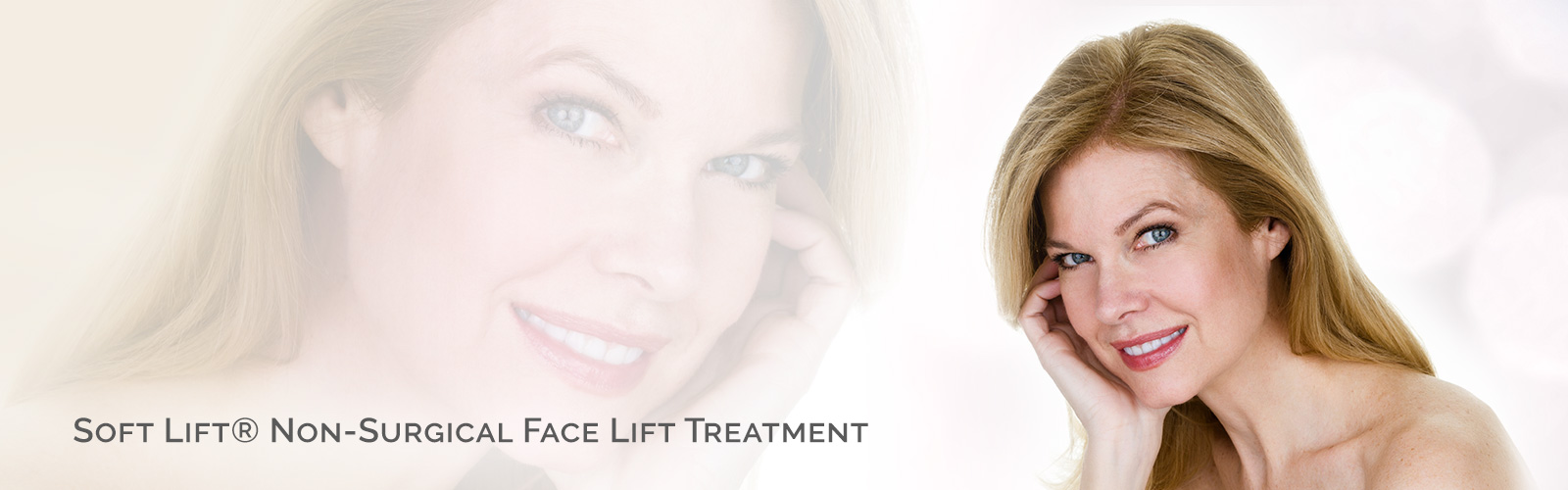 Soft Lift® Non-Surgical Face Lift Treatment