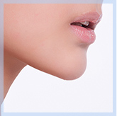 Chin Implant (Chin Augmentation)